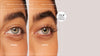 Prima e dopo revitalash advanced
